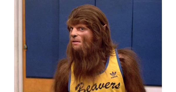 ΣΟΚ στην Ισπανία! Μωρά αναπτύσσουν «σύνδρομο λυκανθρώπου» μετά από ιατρική διαταραχή